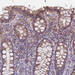 Lysine-rich coiled-coil 1 Antibody, Novus Biologicals 0.1mL; Unlabeled:Antibodies,